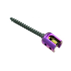 6.0mm Spinal Pedicle Screw System