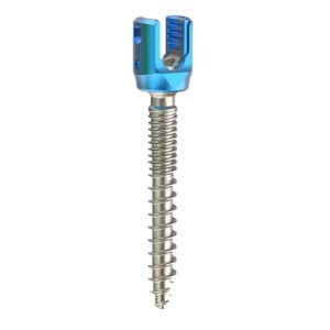 Pedicle Screws Upgraded Usmart 5.5 Spinal Screw-Rod System